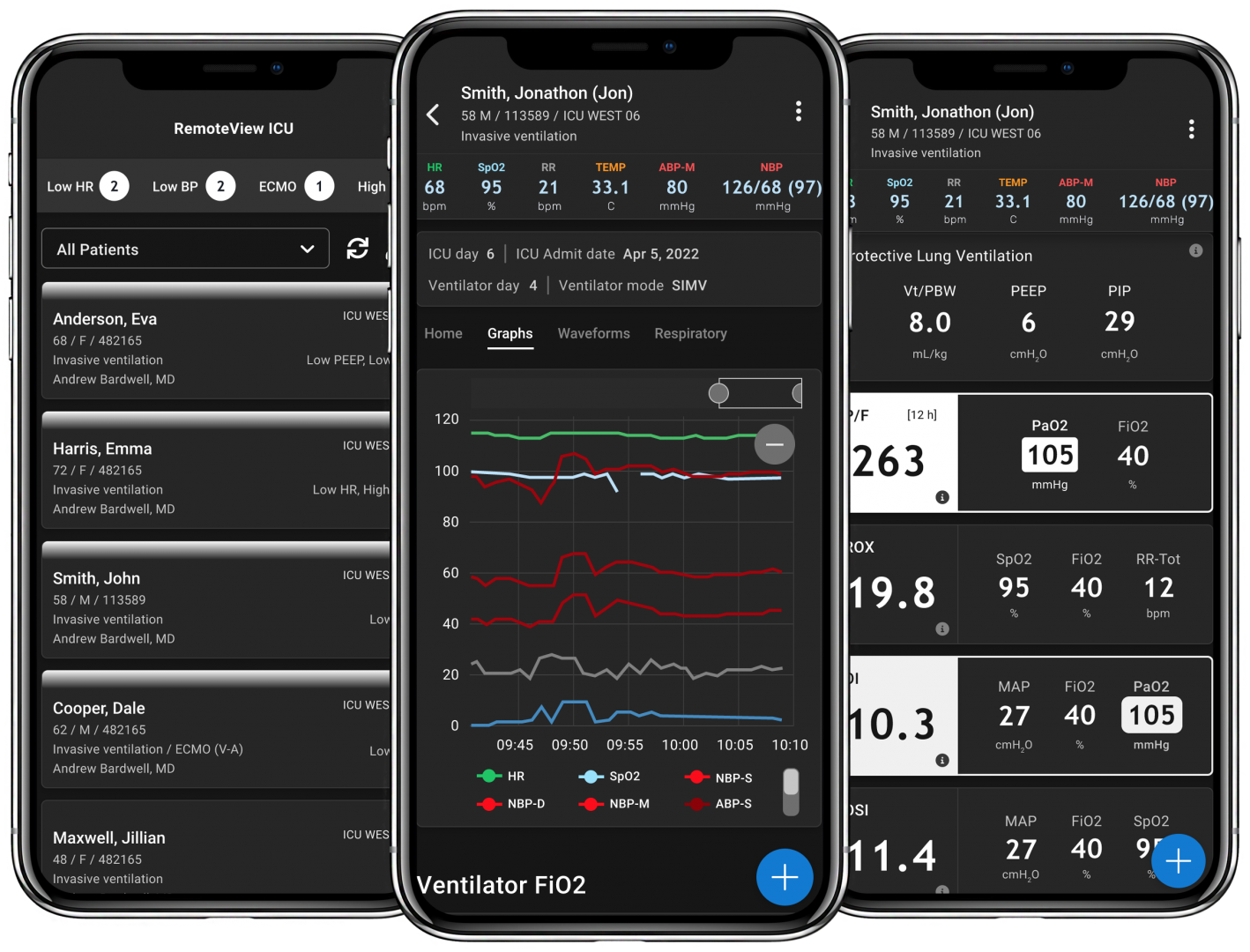 RemoteView Screens