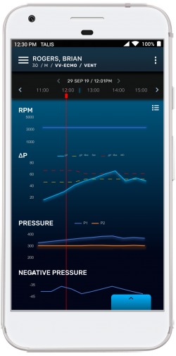 ECMO software waveforms in real-time.