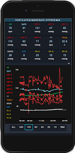 ACG-RemoteView ICU