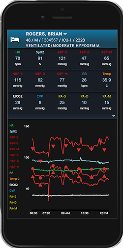 ACG-RemoteView ICU real-time wave forms